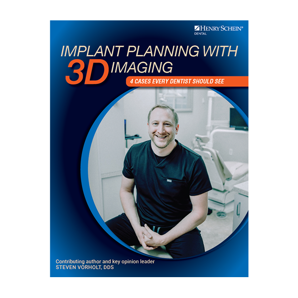  Implant Planning with 3D Imaging